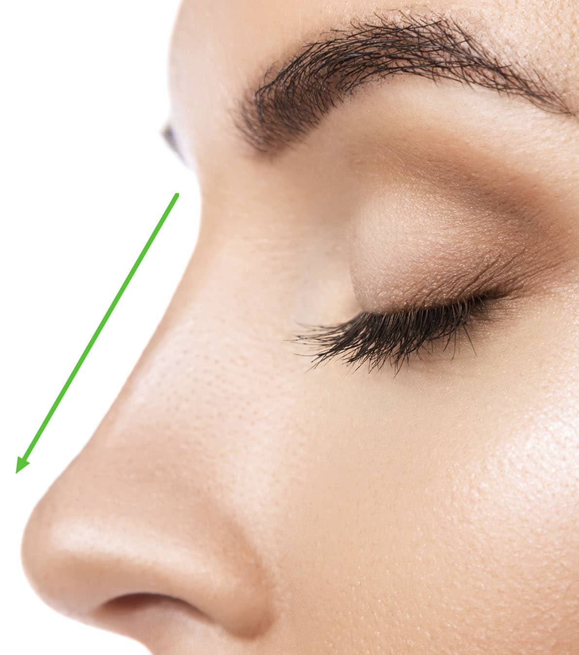 Rhinoplastie centre esthétique Cannes Mougins
